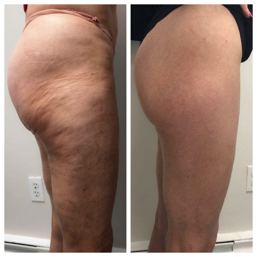 MAIREN™ Sculpt Pro